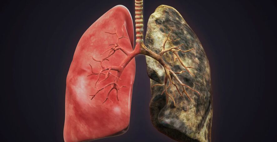 fajčiarske pľúca a prestať fajčiť